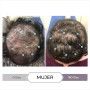 Spectral CSF envejecimiento del cabello mujer con nanoxidil 5% 60ml - DS Laboratories