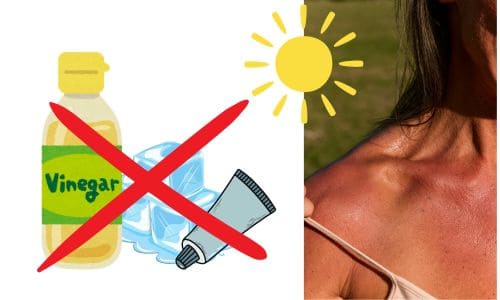Que no hacer con las quemaduras del sol